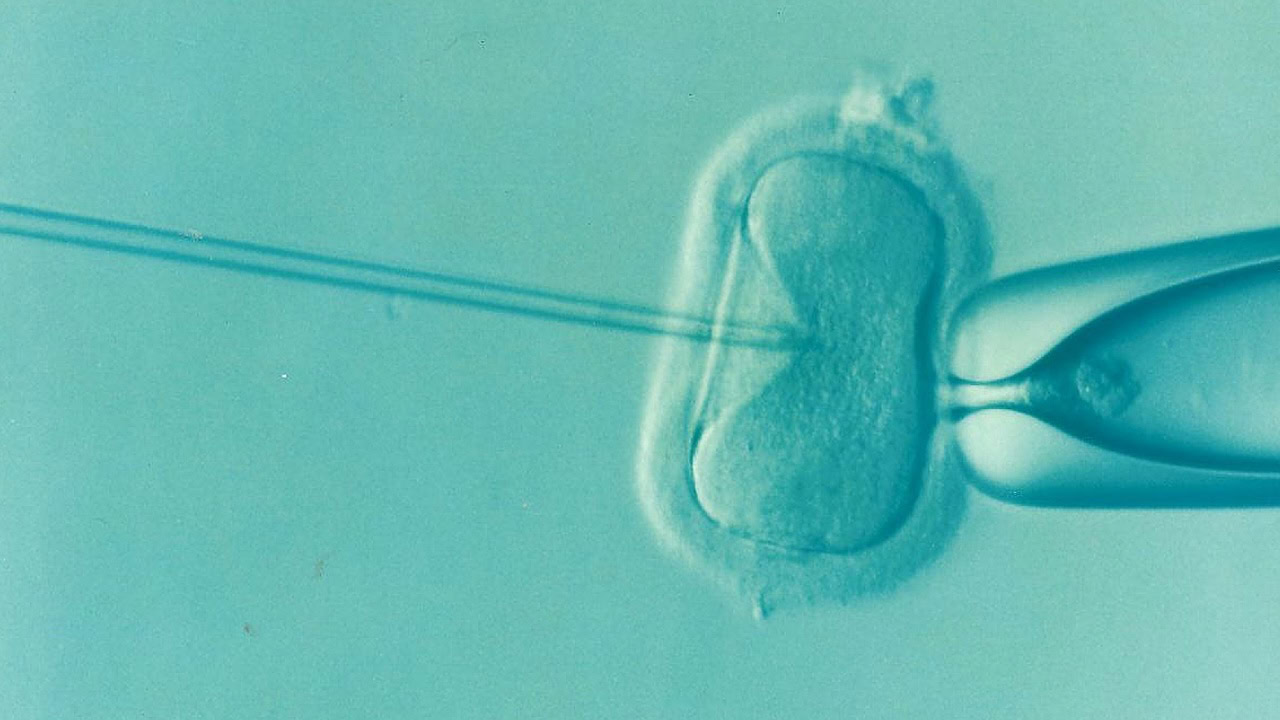 IVF процедура